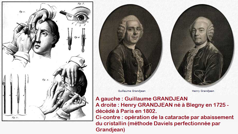 Grandjean oculistes 1